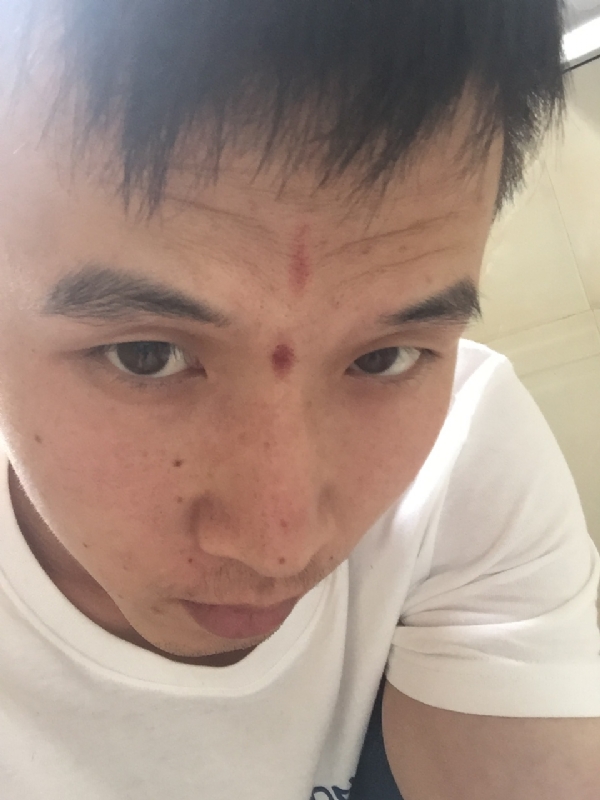 爱晴的第一张照片--光泽相亲网
